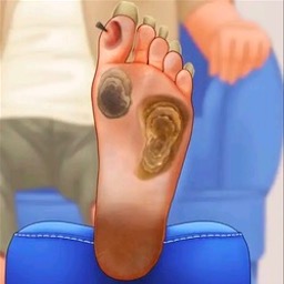 修脚足疔模拟器离线版