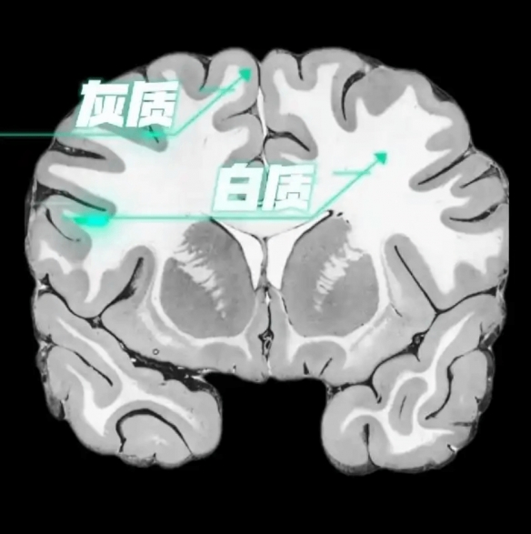 无需为年龄而焦虑！研究显示中国人的大脑发育高峰约在38岁附近