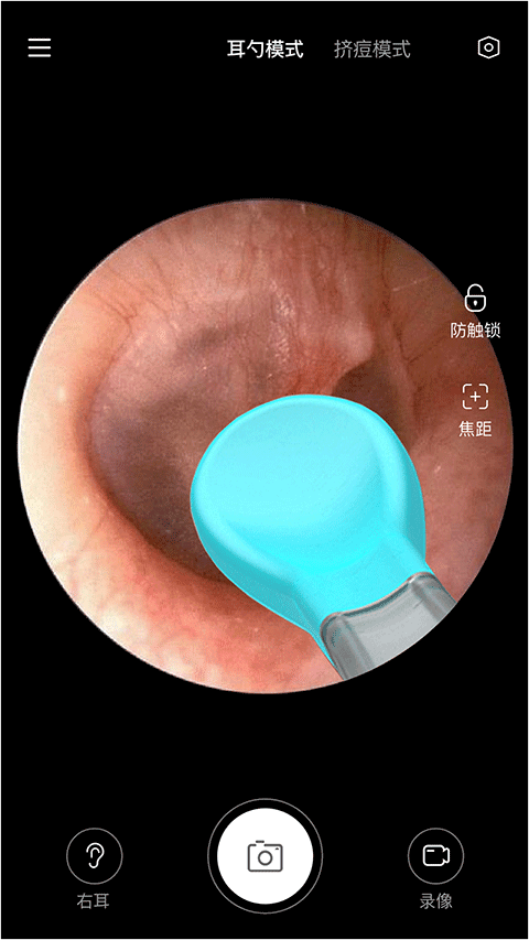 Xlife掏耳勺官网版