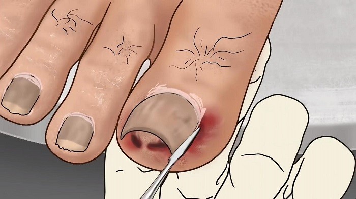 修脚足疔模拟器精简版