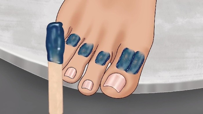 修脚足疔模拟器精简版