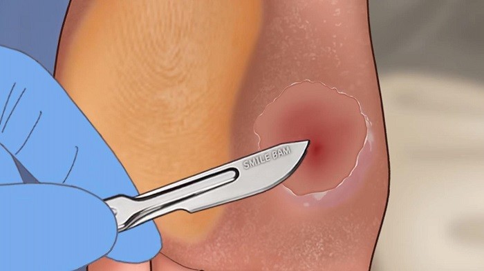 修脚足疔模拟器精简版